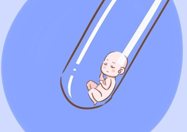 先天性无子宫