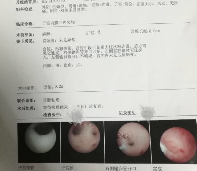 全麻后遗症