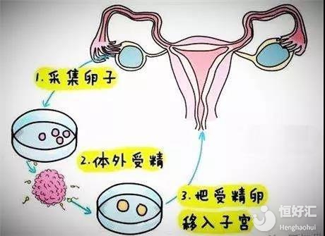 儿童心理健康